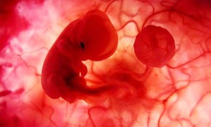 embrion 300x180 El decálogo contra el aborto químico / Un aborto es siempre un aborto